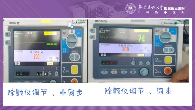 急救必备 | 除颤仪的使用7607 作者:Good 帖子ID:13101 急救必备,除颤仪,使用
