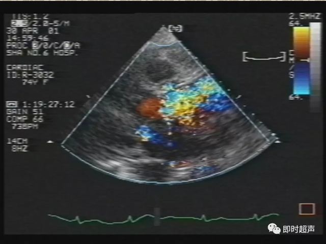 25种常见心脏疾病超声诊断1216 作者:笔墨苍炎 帖子ID:20241 常见心脏疾病