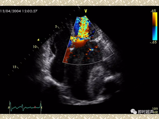 25种常见心脏疾病超声诊断6345 作者:笔墨苍炎 帖子ID:20241 常见心脏疾病
