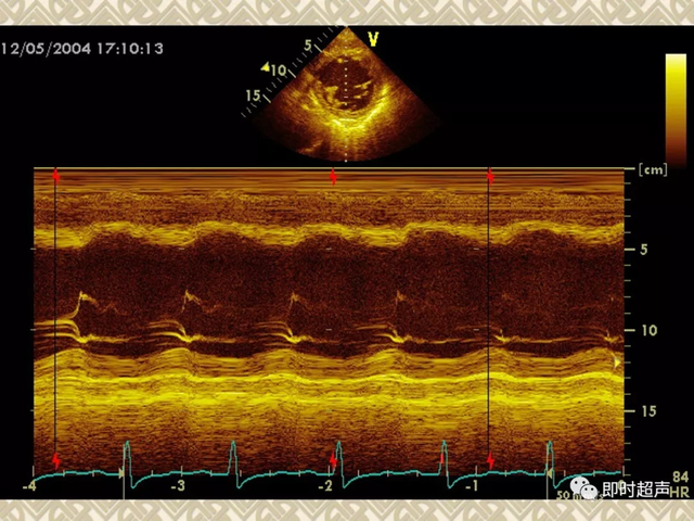 25种常见心脏疾病超声诊断1039 作者:笔墨苍炎 帖子ID:20241 常见心脏疾病