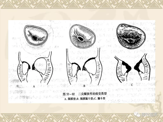 25种常见心脏疾病超声诊断1024 作者:笔墨苍炎 帖子ID:20241 常见心脏疾病