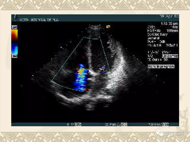 25种常见心脏疾病超声诊断7184 作者:笔墨苍炎 帖子ID:20241 常见心脏疾病