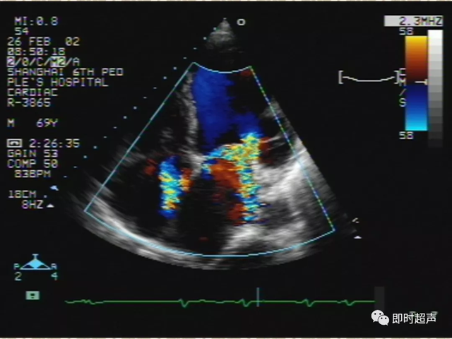 25种常见心脏疾病超声诊断8169 作者:笔墨苍炎 帖子ID:20241 常见心脏疾病