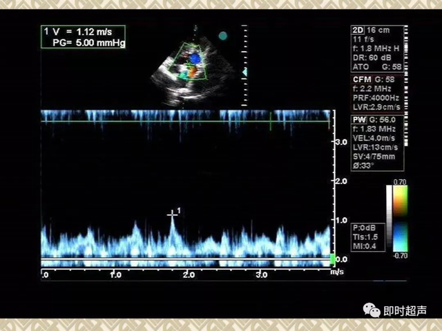 25种常见心脏疾病超声诊断6050 作者:笔墨苍炎 帖子ID:20241 常见心脏疾病