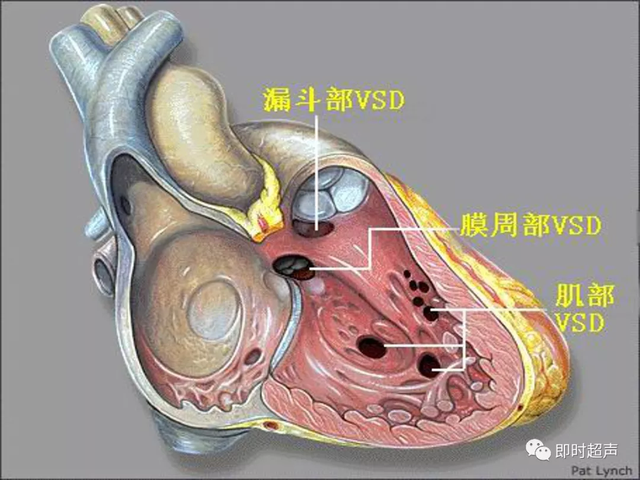 25种常见心脏疾病超声诊断1498 作者:笔墨苍炎 帖子ID:20241 常见心脏疾病