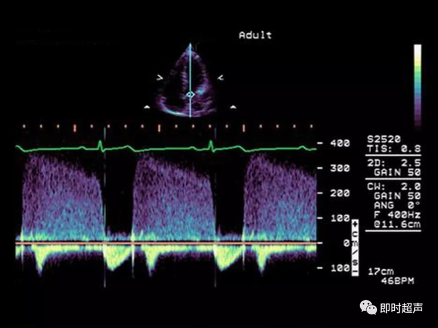 25种常见心脏疾病超声诊断6592 作者:笔墨苍炎 帖子ID:20241 常见心脏疾病