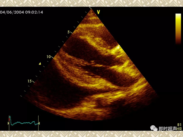 25种常见心脏疾病超声诊断2688 作者:笔墨苍炎 帖子ID:20241 常见心脏疾病
