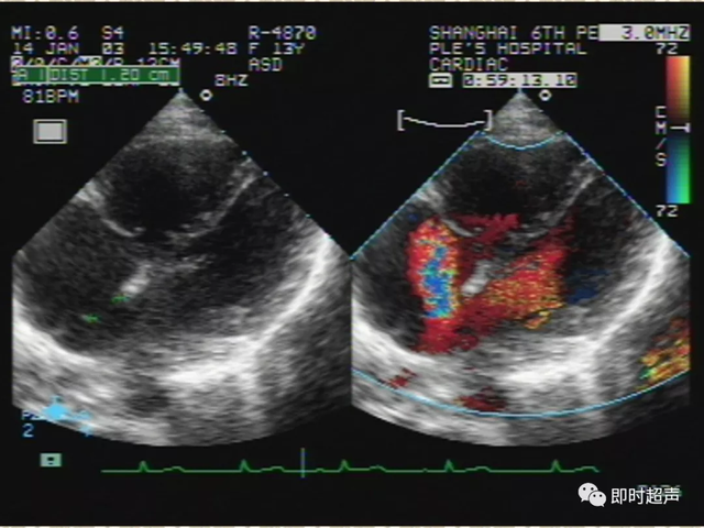 25种常见心脏疾病超声诊断7139 作者:笔墨苍炎 帖子ID:20241 常见心脏疾病