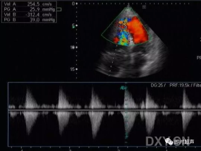 25种常见心脏疾病超声诊断772 作者:笔墨苍炎 帖子ID:20241 常见心脏疾病