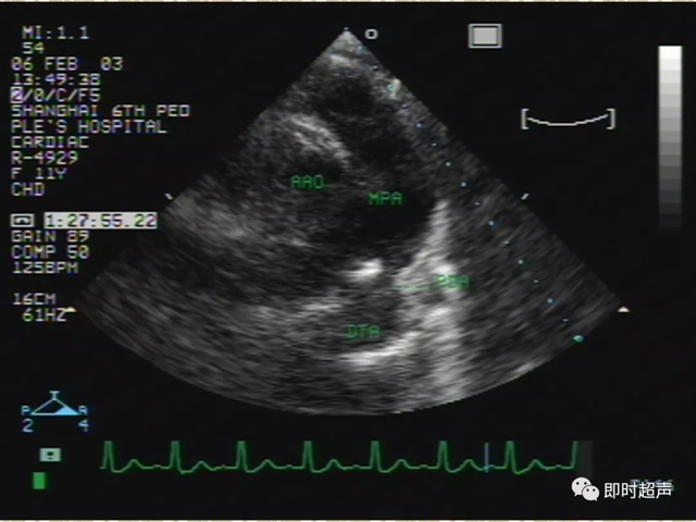 25种常见心脏疾病超声诊断6110 作者:笔墨苍炎 帖子ID:20241 常见心脏疾病