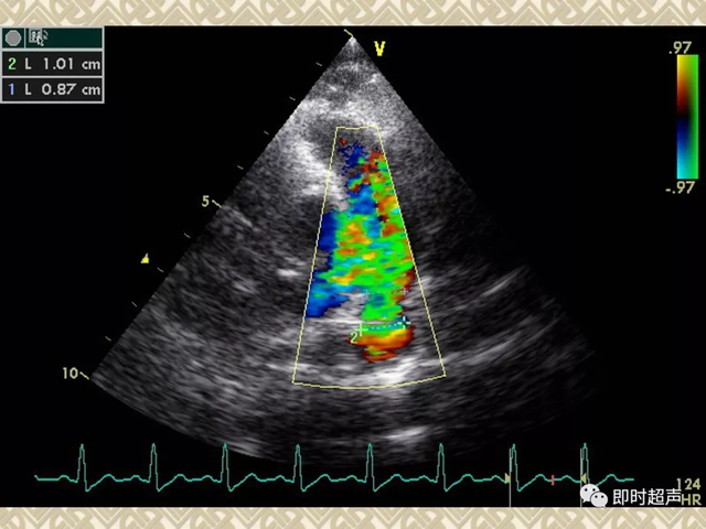 25种常见心脏疾病超声诊断1788 作者:笔墨苍炎 帖子ID:20241 常见心脏疾病