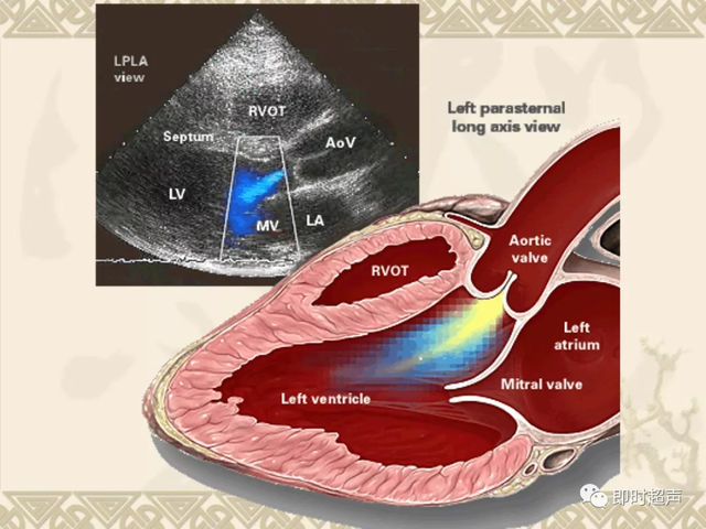 25种常见心脏疾病超声诊断8843 作者:笔墨苍炎 帖子ID:20241 常见心脏疾病