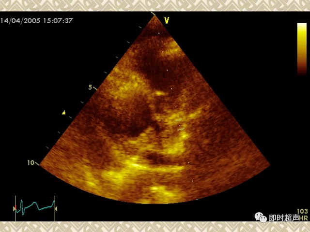 25种常见心脏疾病超声诊断8601 作者:笔墨苍炎 帖子ID:20241 常见心脏疾病