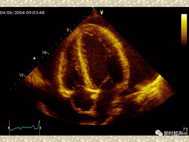 25种常见心脏疾病超声诊断7846 作者:笔墨苍炎 帖子ID:20241 常见心脏疾病