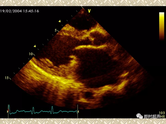 25种常见心脏疾病超声诊断7473 作者:笔墨苍炎 帖子ID:20241 常见心脏疾病