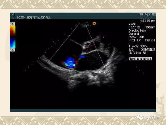 25种常见心脏疾病超声诊断4868 作者:笔墨苍炎 帖子ID:20241 常见心脏疾病