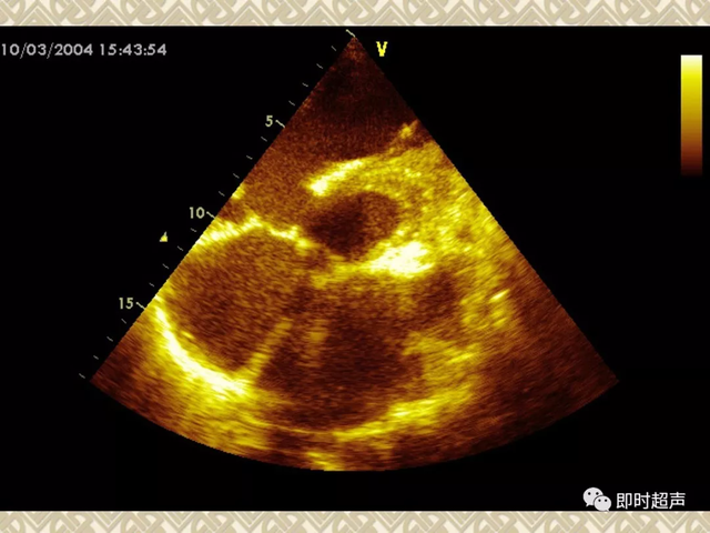 25种常见心脏疾病超声诊断1297 作者:笔墨苍炎 帖子ID:20241 常见心脏疾病