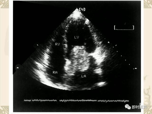 25种常见心脏疾病超声诊断9712 作者:笔墨苍炎 帖子ID:20241 常见心脏疾病
